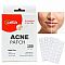 naplasti na akne 180ks 