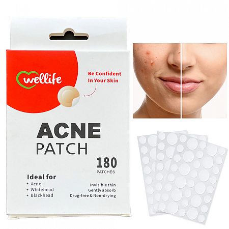 naplasti na akne 180ks 